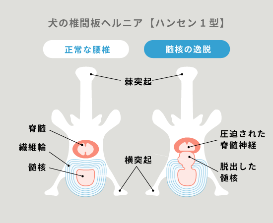 犬の椎間板ヘルニア【ハンセン1型】